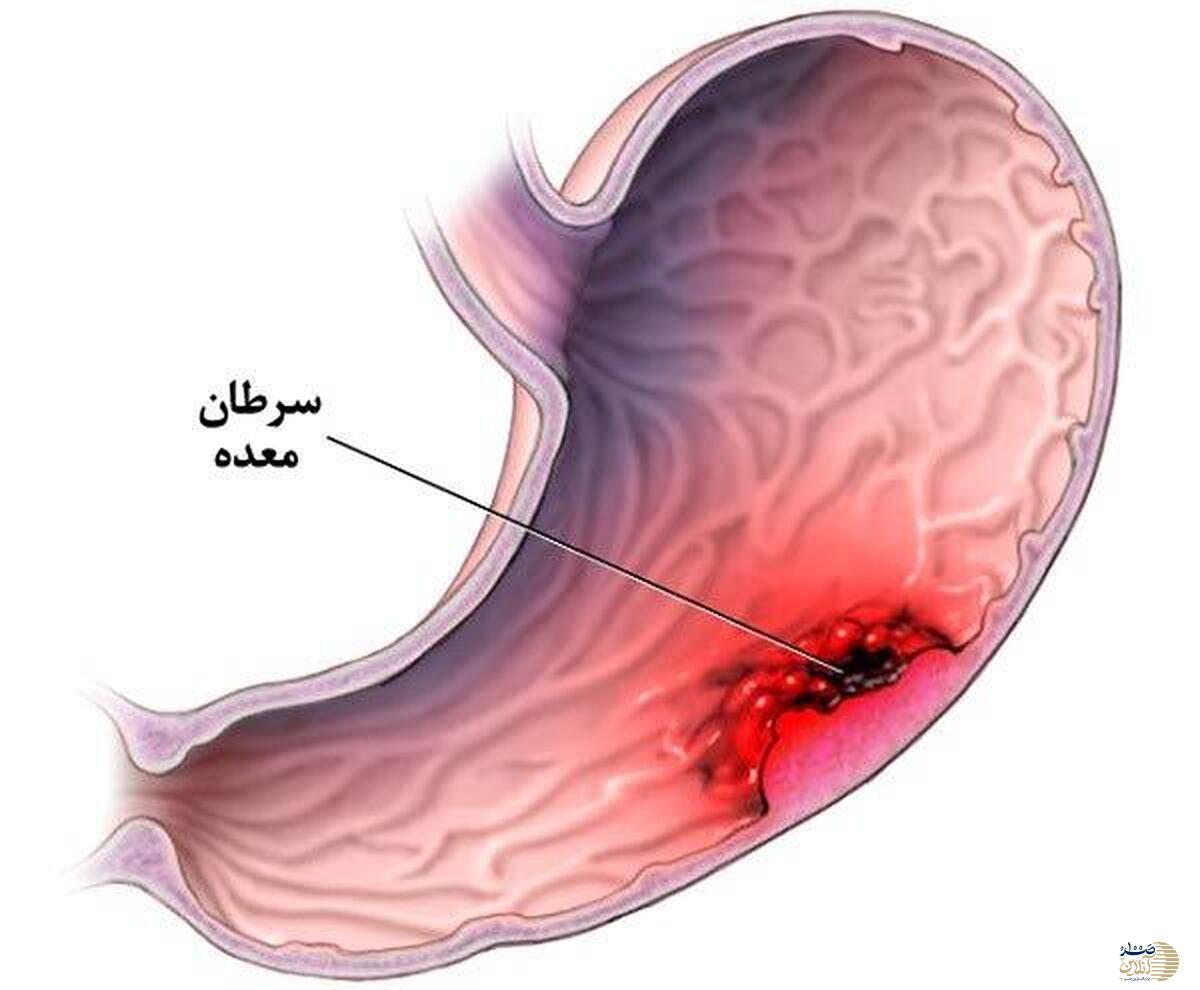 این علائم یعنی شما در یک قدمی بیماری کشنده هستید