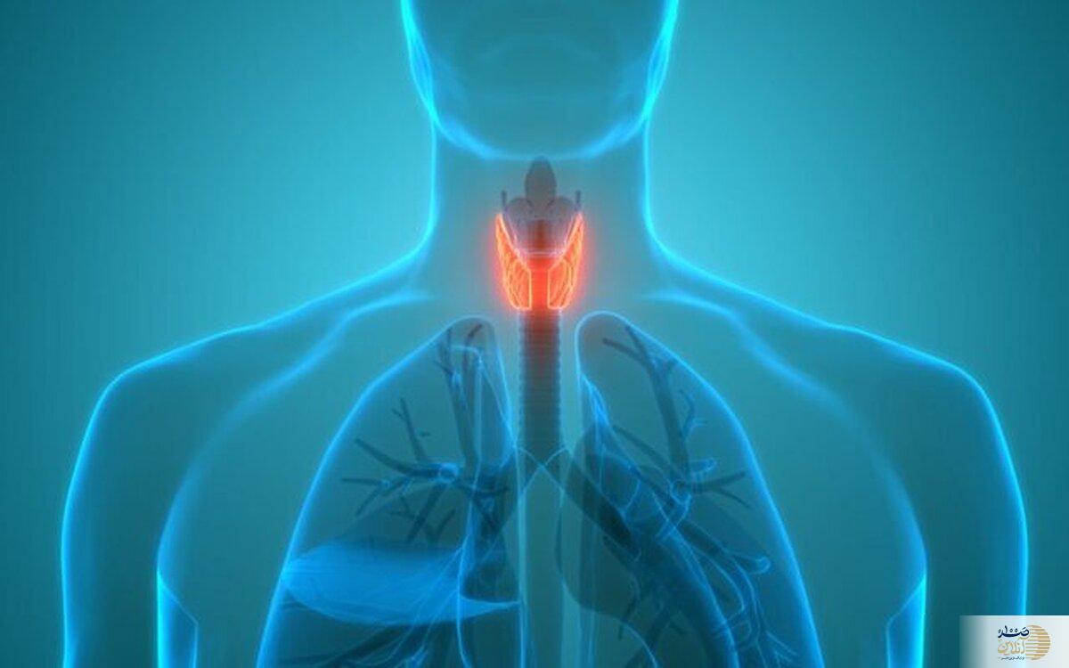 پرکاری تیروئید شما را اذیت می کند راه حل شما اینجاست