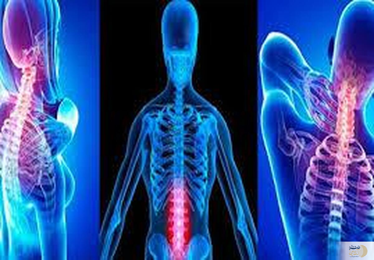 ناگفته های تازه از بیماری استخوان ها که نمی دانستید