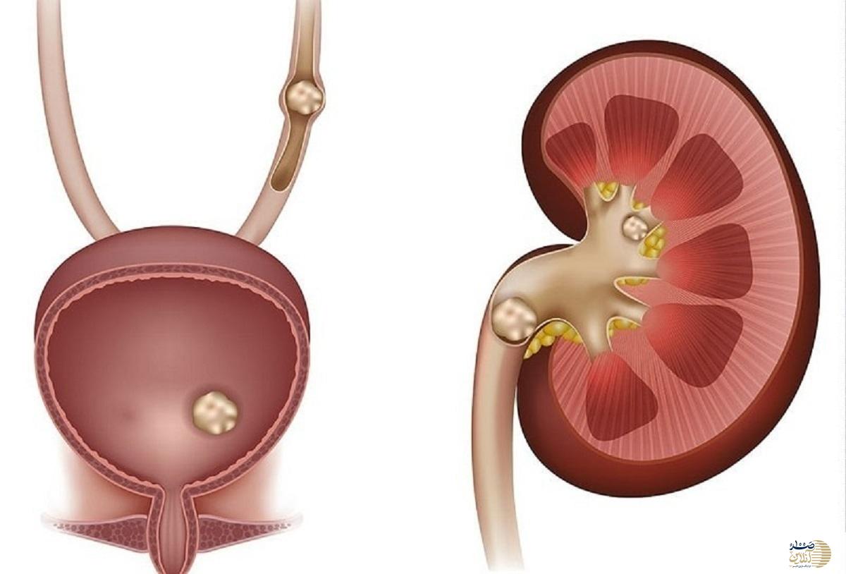 بیش از حد این داروهای دم دستی را مصرف نکنید تا کلیه شما سالم بماند