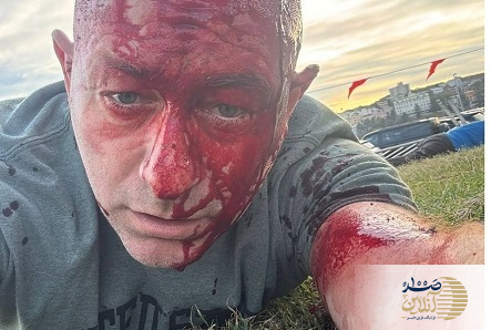 لحظه خلع سلاح یکی از مهاجمین در سیدنی