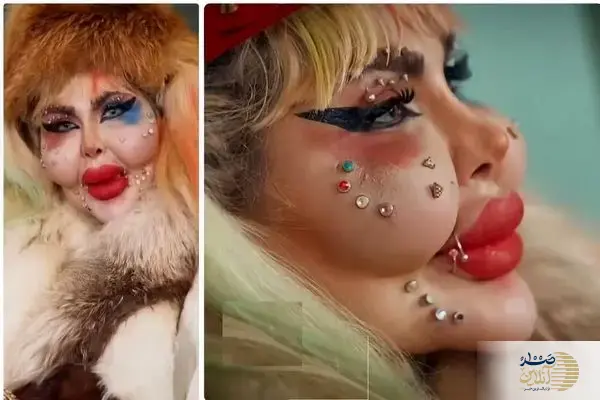 ببینید/ زن ایرانی رکورددار عمل جراحی زیبایی در کتاب گینس شد