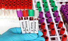 این گروه خونی بیشتر سکته می کنند