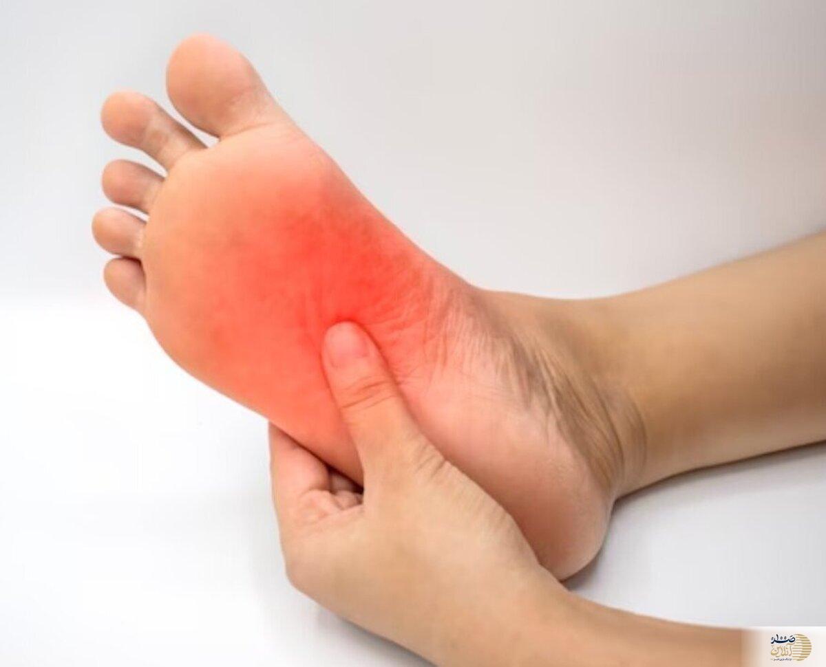 داغی کف پا در شب را جدی بگیرید