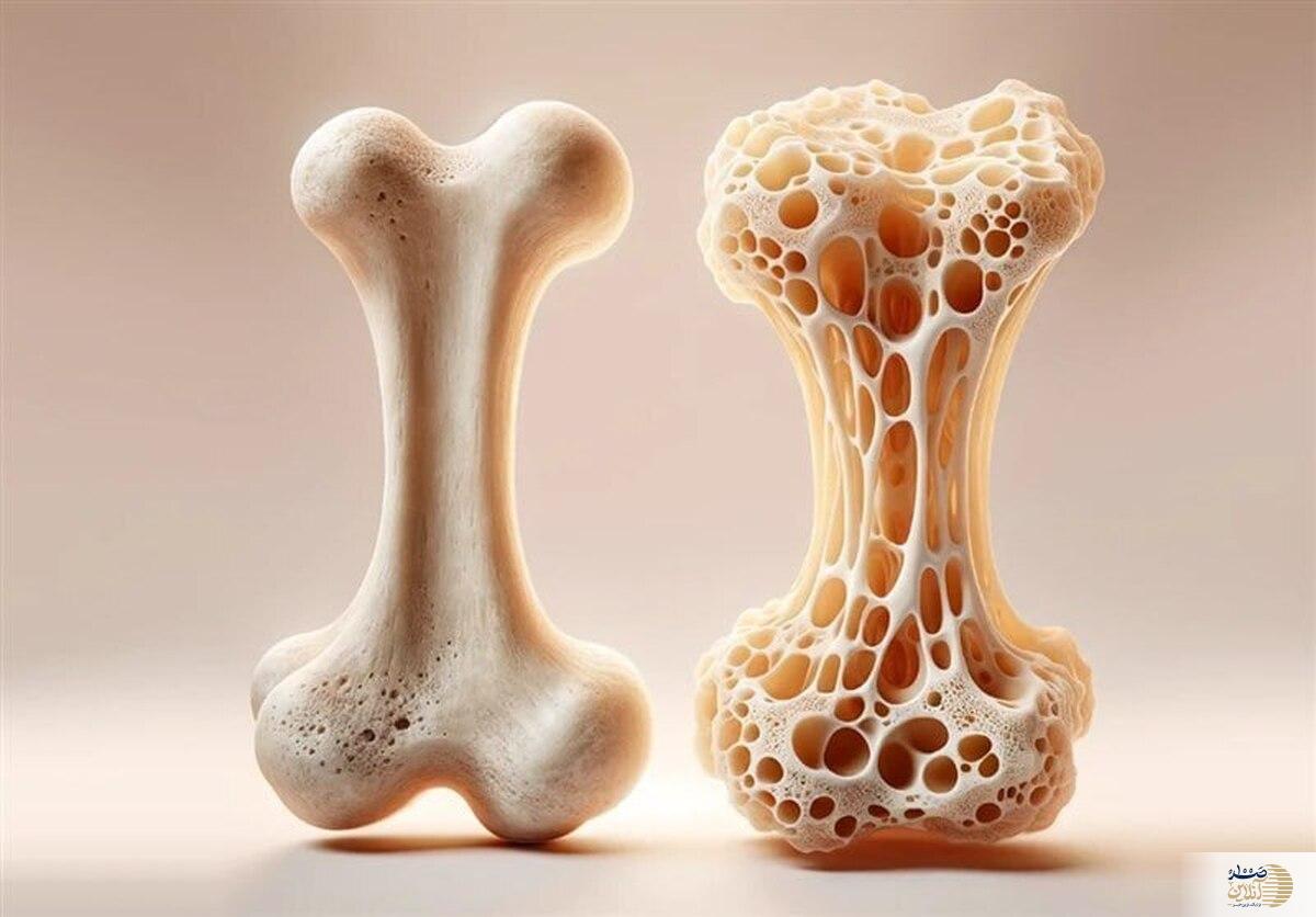 اگر بیش از حد پروتئین مصرف می کنید منتظر پوکی استخوان باشید