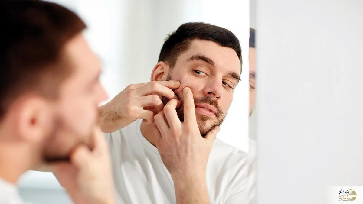 بمب‌های ضدجوش/ پنج ماده موثر برای پاکسازی پوست و نابودی آکنه