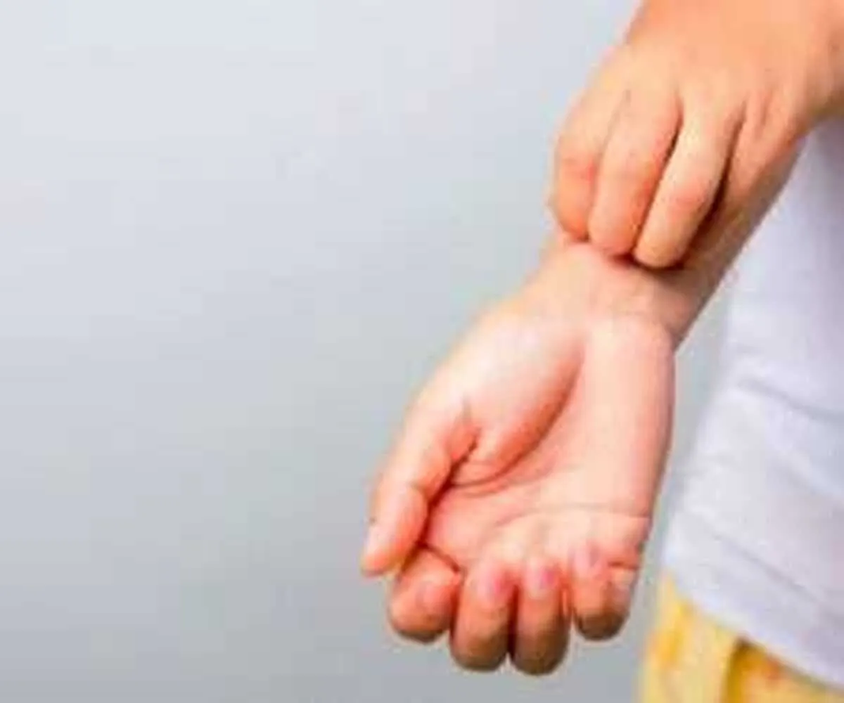اگر همیشه احساس می کنید  پوستتان می خارد ، بخوانید