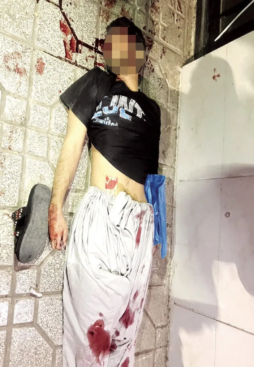 قتل مرد جوان با شلیک ۱۰ گلوله مقابل خانه |‌ ردپای انتقام در قتل | عکس ۱۸+