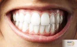 دندان‌های خراب را جدی بگیرید/ خطر در کمین است