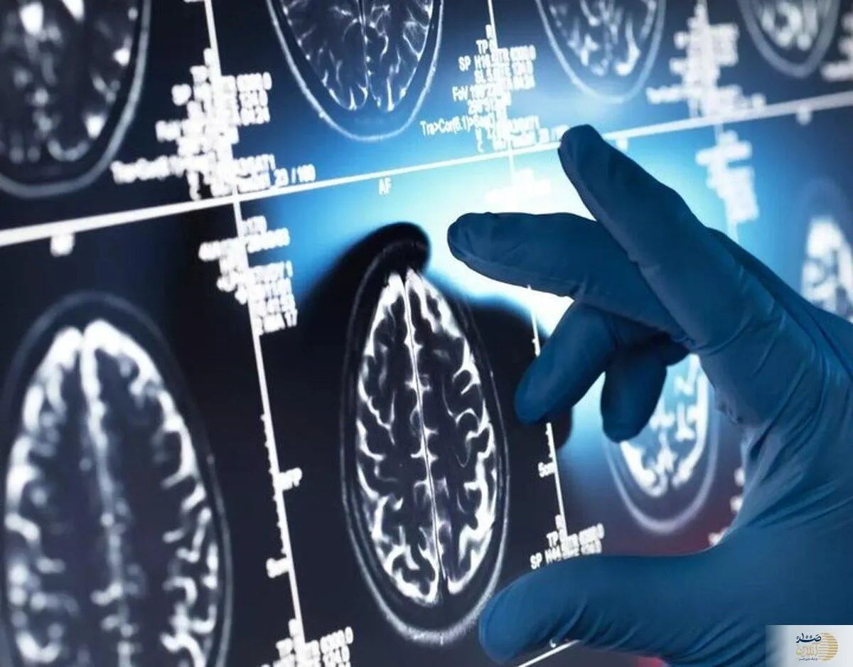 با این گیاه معروف آلزایمر را دور بزنید