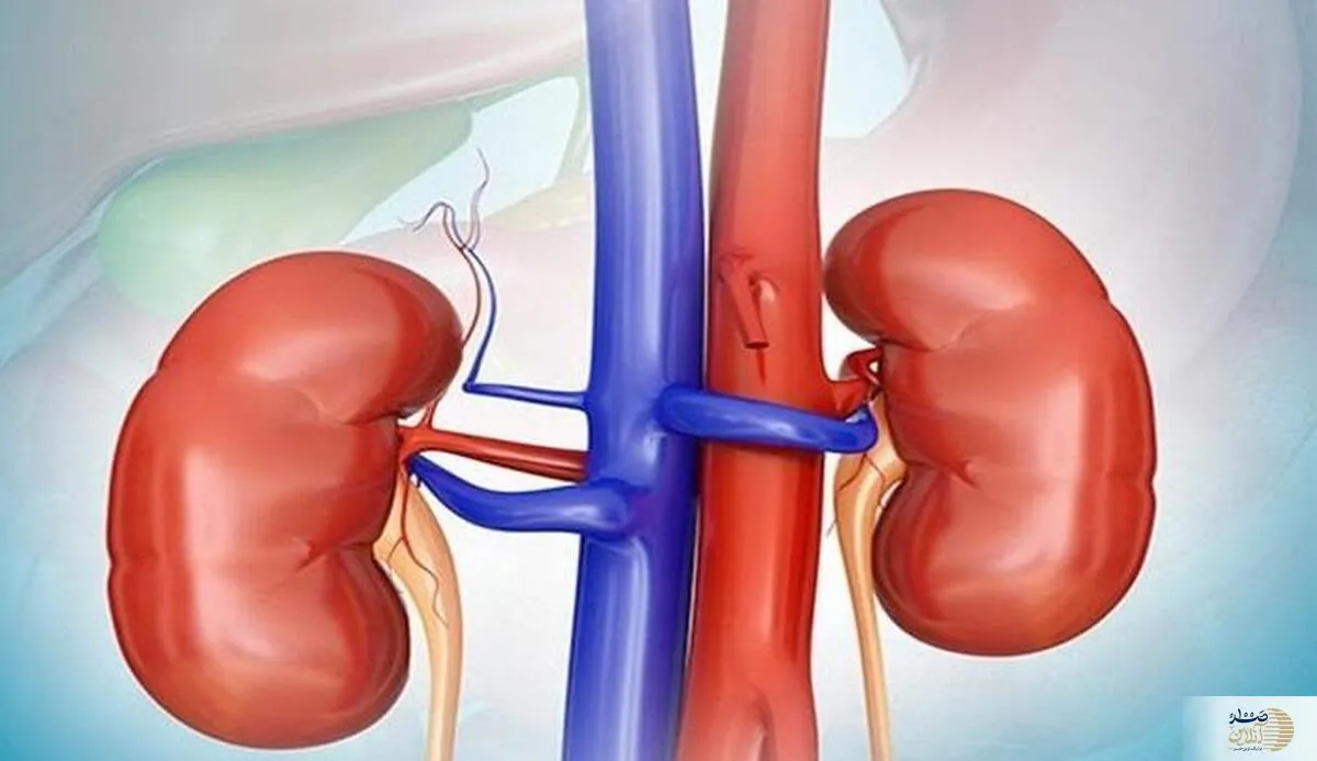 این نوشیدنی سنگ کلیه را از بین می برد؟