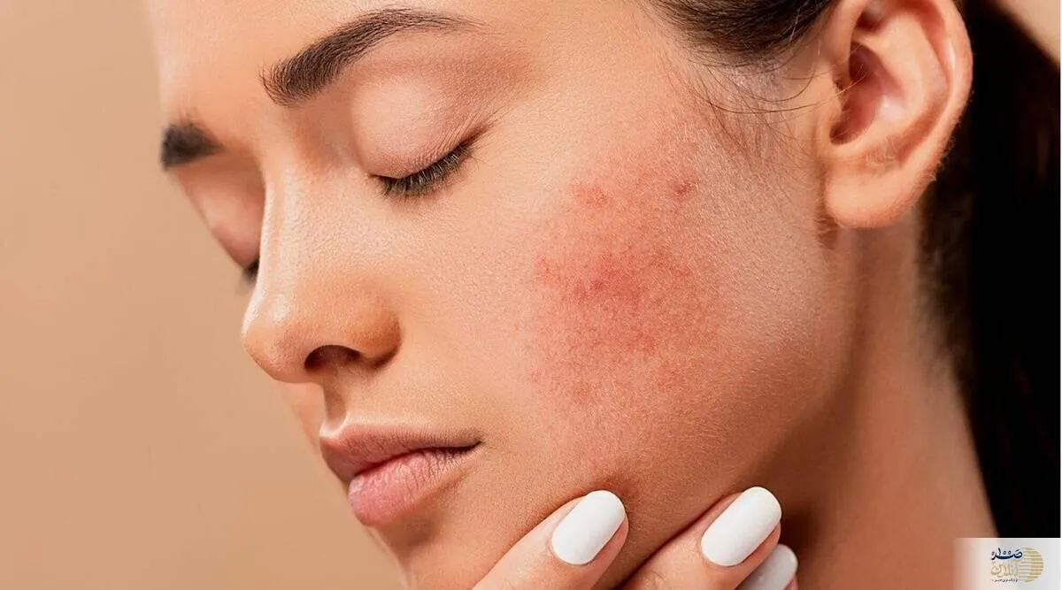 این ۷ علایم پوستی را جدی بگیرید یعنی شما بیمار هستید