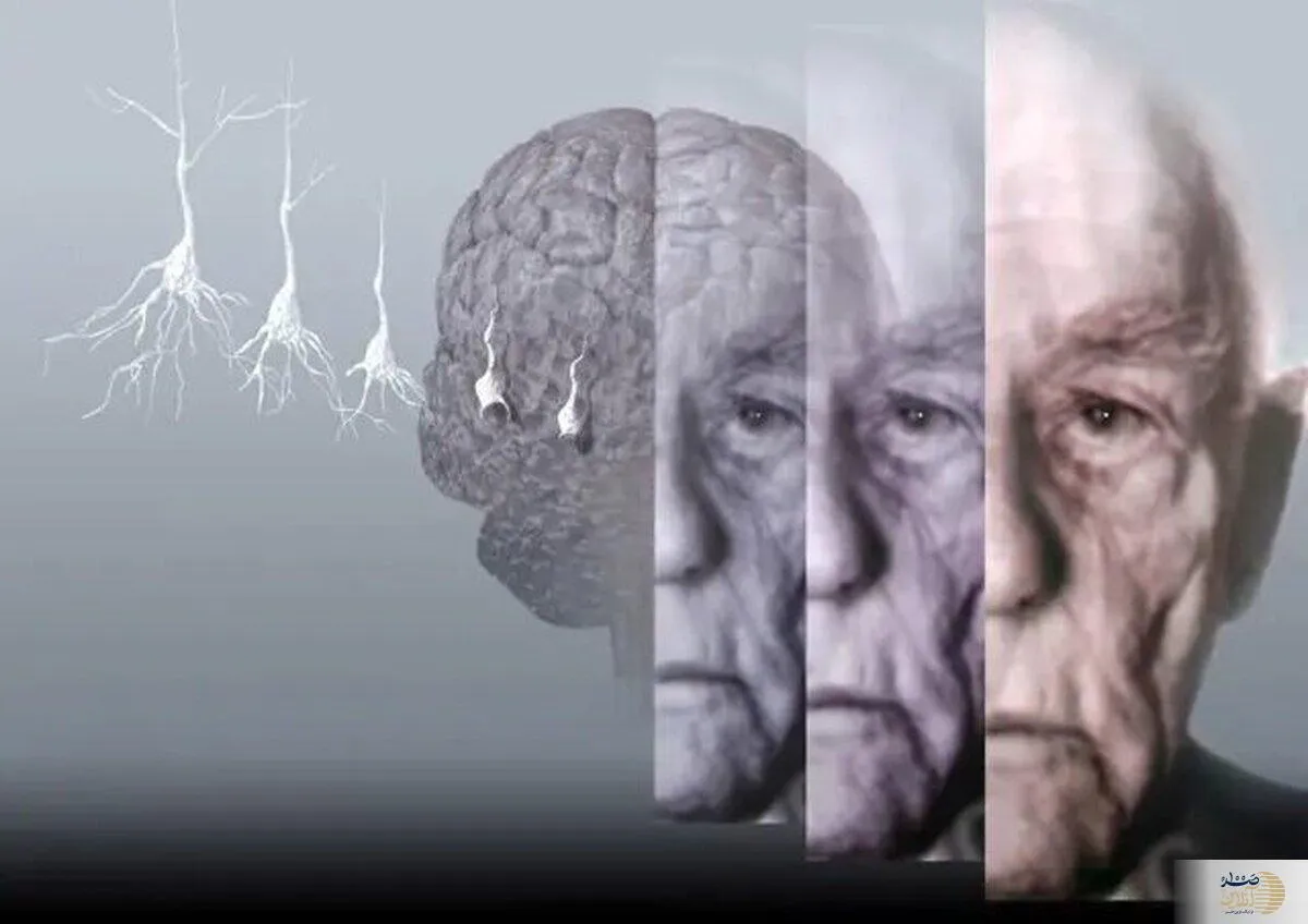 با رعایت این ۷ مورد آلزایمر را دور بزنید