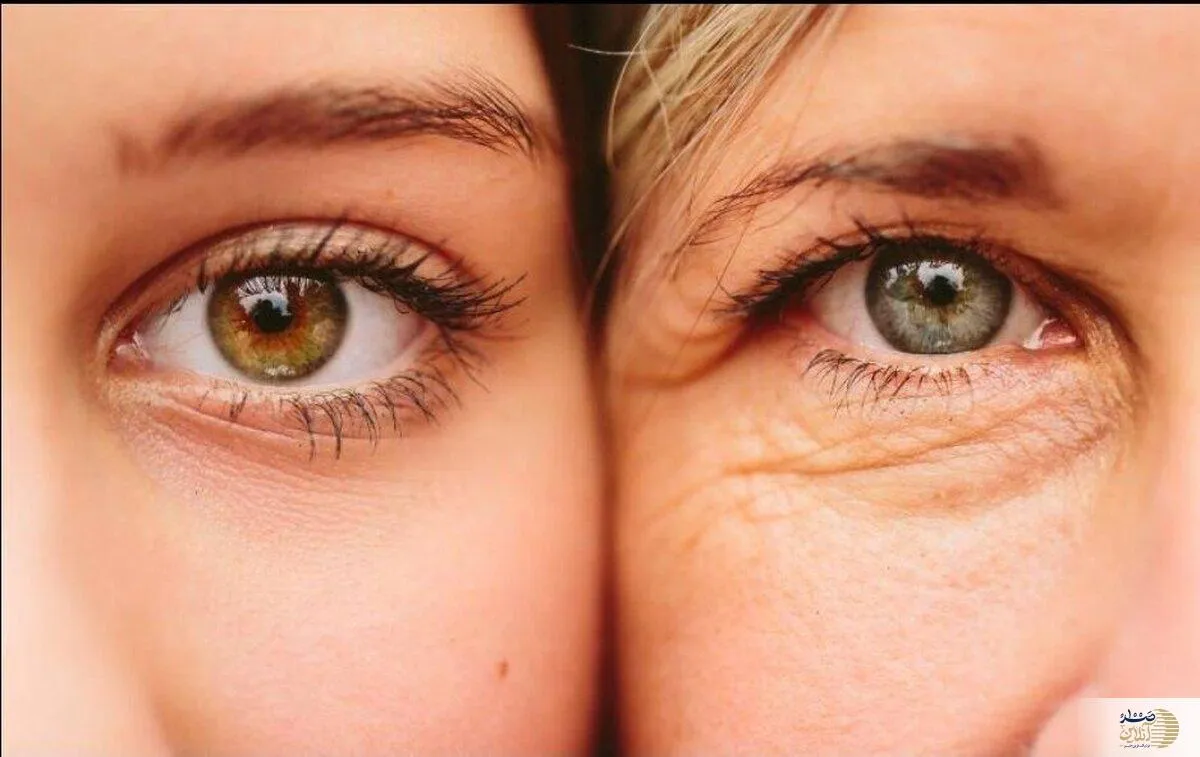 کلاژن، معجزه‌ای برای پوست و آرتروز یا فقط یک مکمل معمولی؟