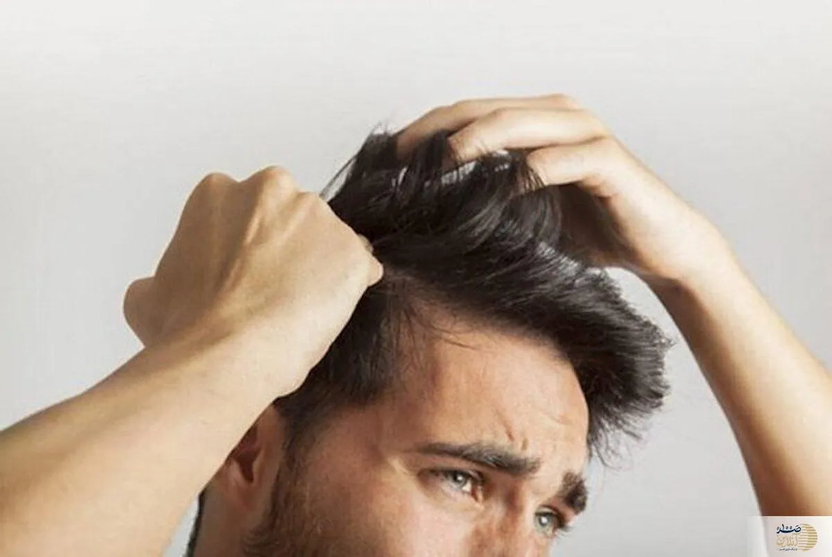 خارش پوست سر/ آیا نشانه‌ای از فقر ویتامین در بدن شماست؟