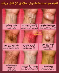 بدن شما در مچ دستتان حرف می‌زند/ پیام‌های پنهان سلامتی را بشناسید