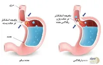 علت زرد شدن پوسیدگی دندان ها مربوط به ضعیف شدن این ناحیه از بدن است / حقیقتی که گفته نمی شود