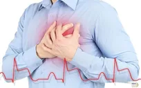 ببینید| ویدیو هولناک از دیدن سکته قلبی