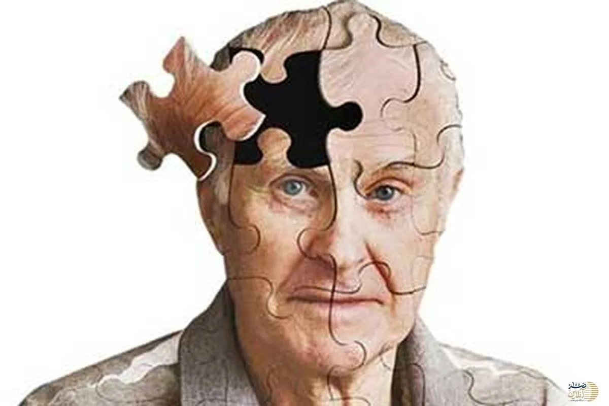 در سه دقیقه آلزایمر را تشخیص دهید!