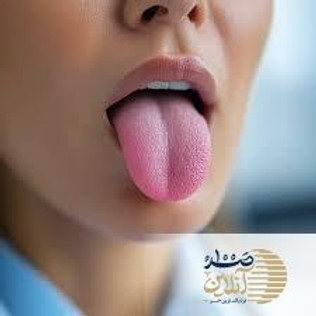 علت قرمز شدن و حساسیت زبان چیست؟