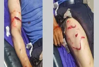مردی هنگام جمع‌آوری گیاهان کوهی در مراغه طعمه حمله خرس شد