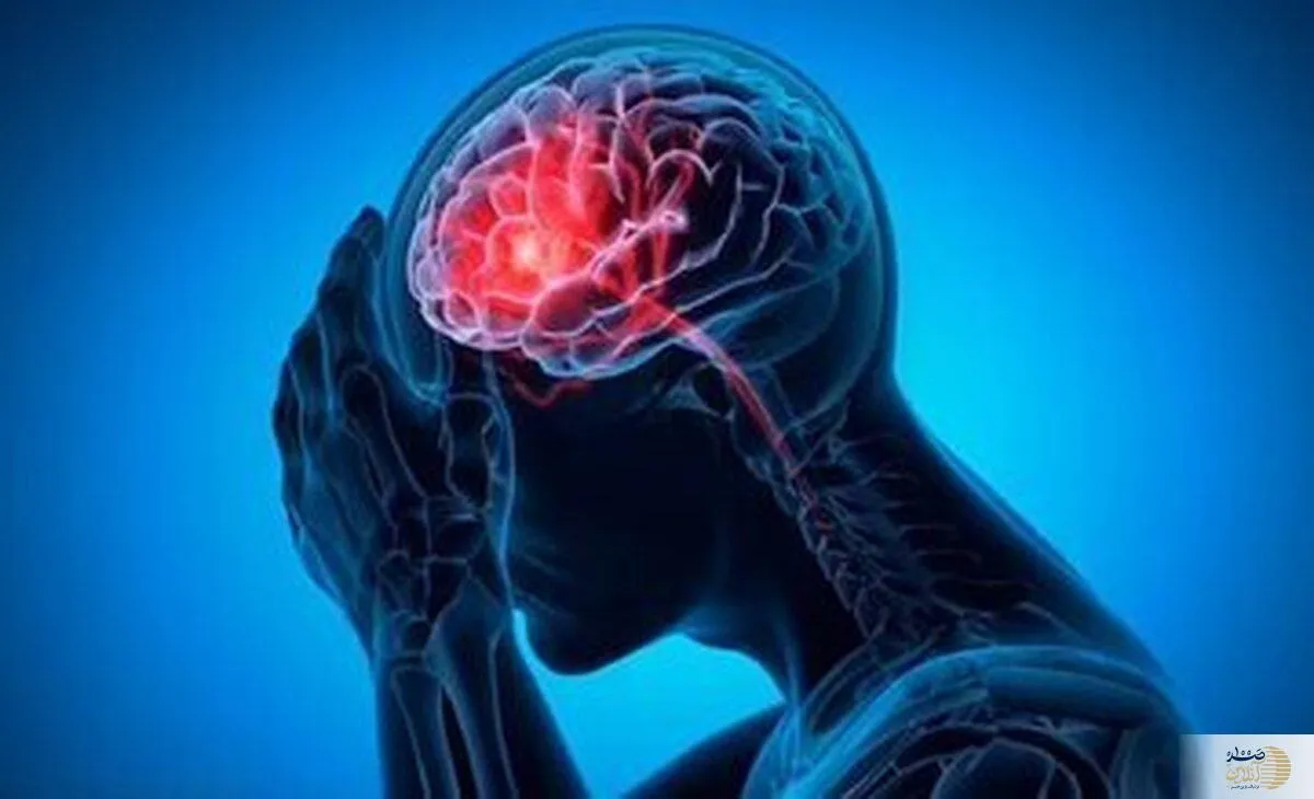 میگرن و افزایش خطر سکته مغزی