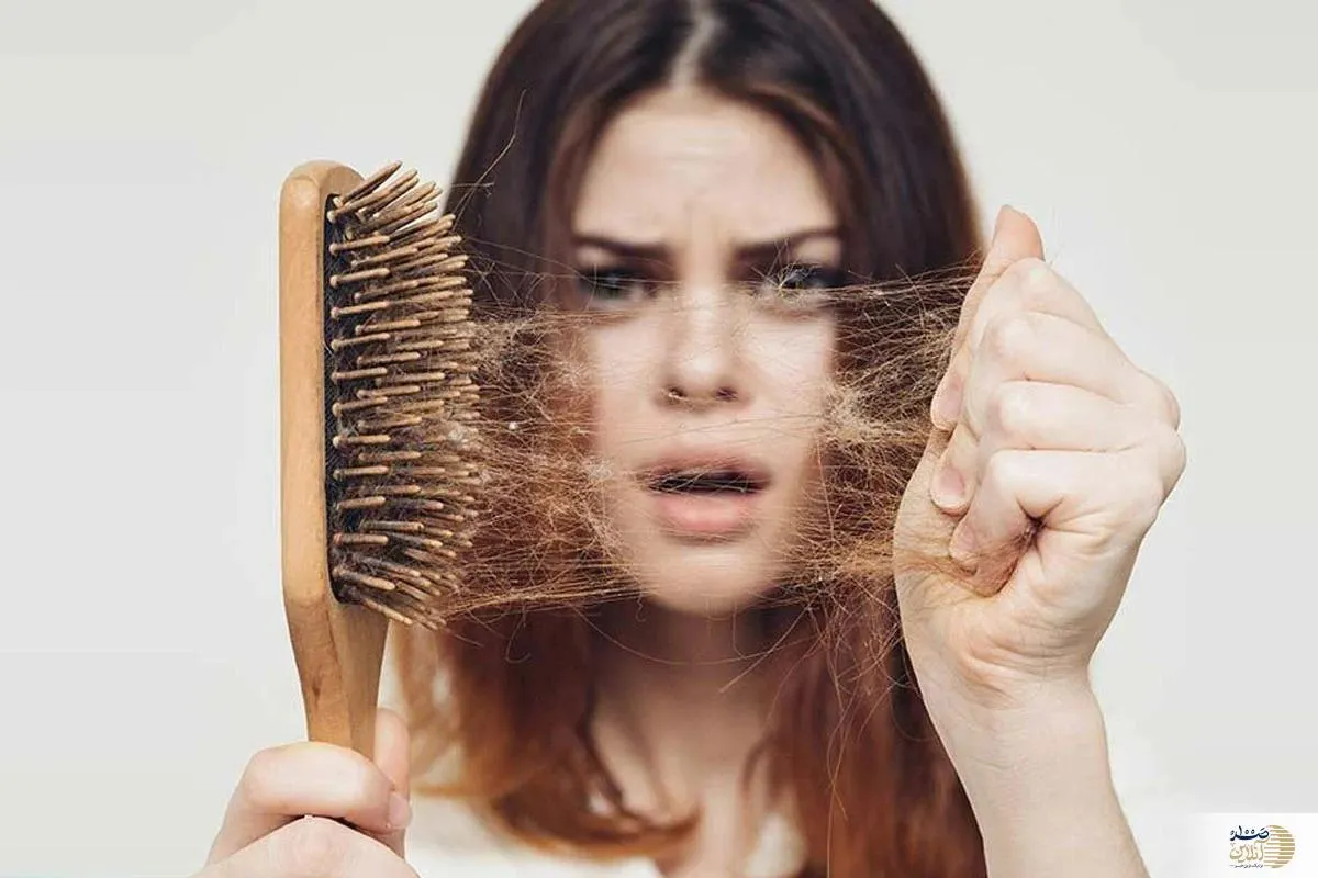 با مصرف این خوراکی ها از ریزش مو راحت می شوید