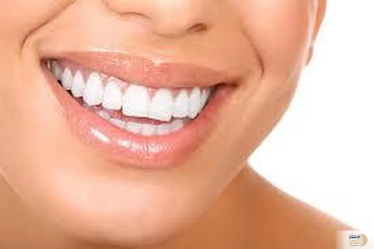 اگر دندان های عین برف سفید و سالم میخواهید این ویتامین را بخورید