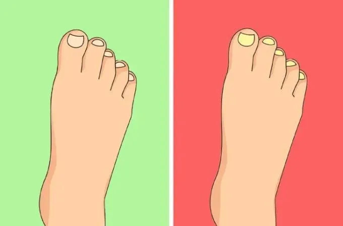 ناخن‌هایتان چه رازی از سلامتی شما فاش می‌کنند؟