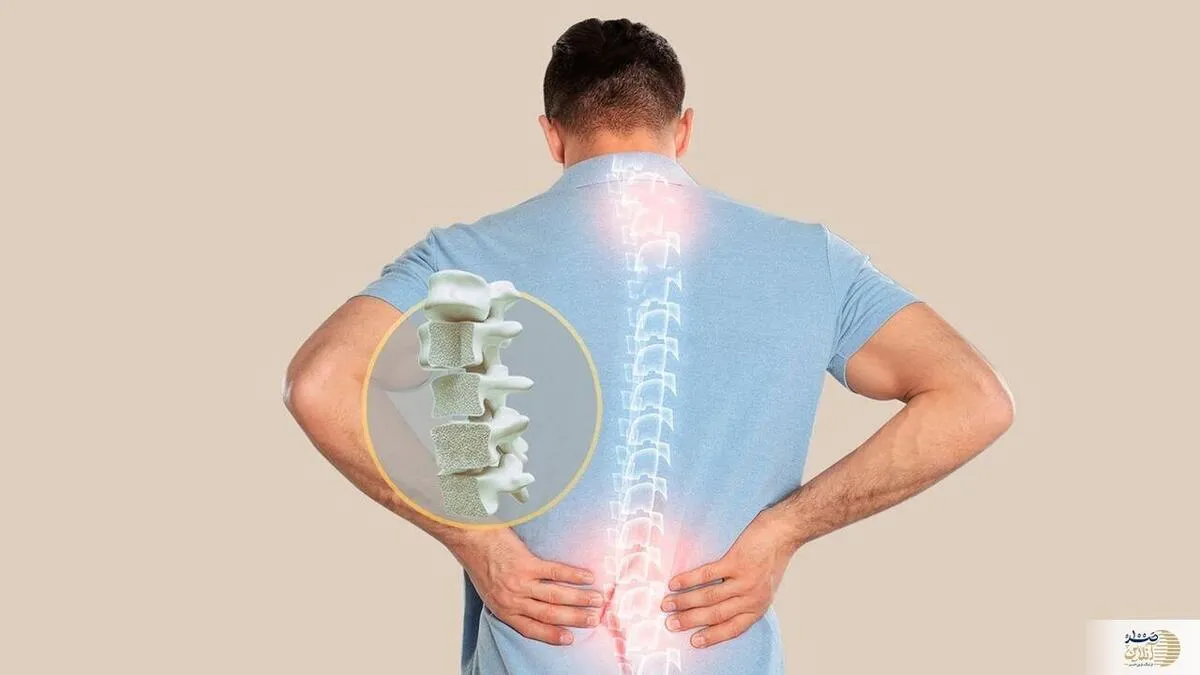 سرعت پوکی استخوان در این شرایط دو برابر می شود